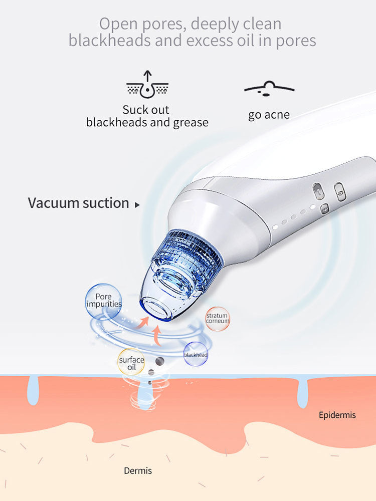 Electric Blackhead Remover with Vacuum Suction